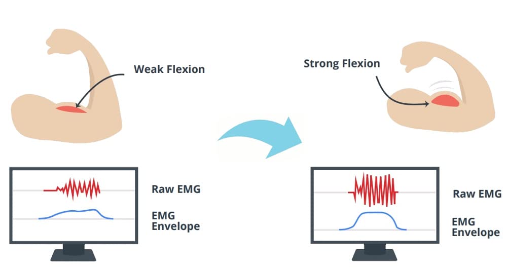 MyoWare Muscle Sensor 2.0 - Compatible with Arduino- All-in-One Electromyography (EMG) Sensor - Keyed Snap Connector