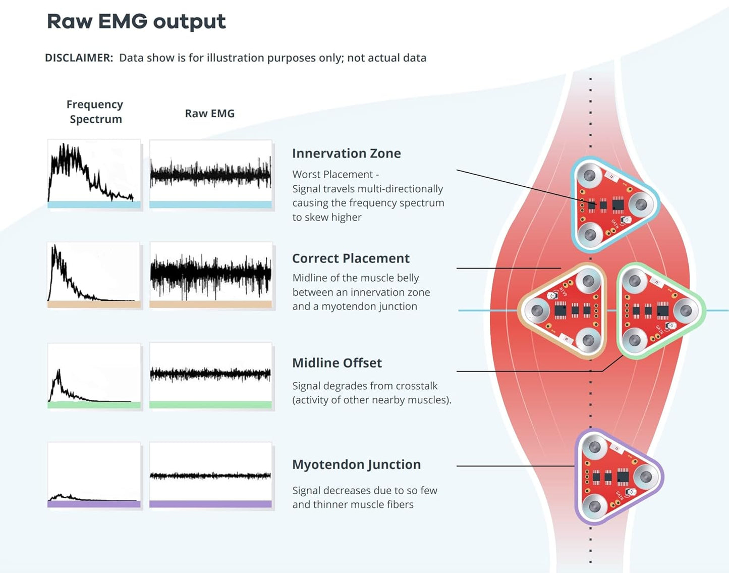 MyoWare Muscle Sensor 2.0 - Compatible with Arduino- All-in-One Electromyography (EMG) Sensor - Keyed Snap Connector